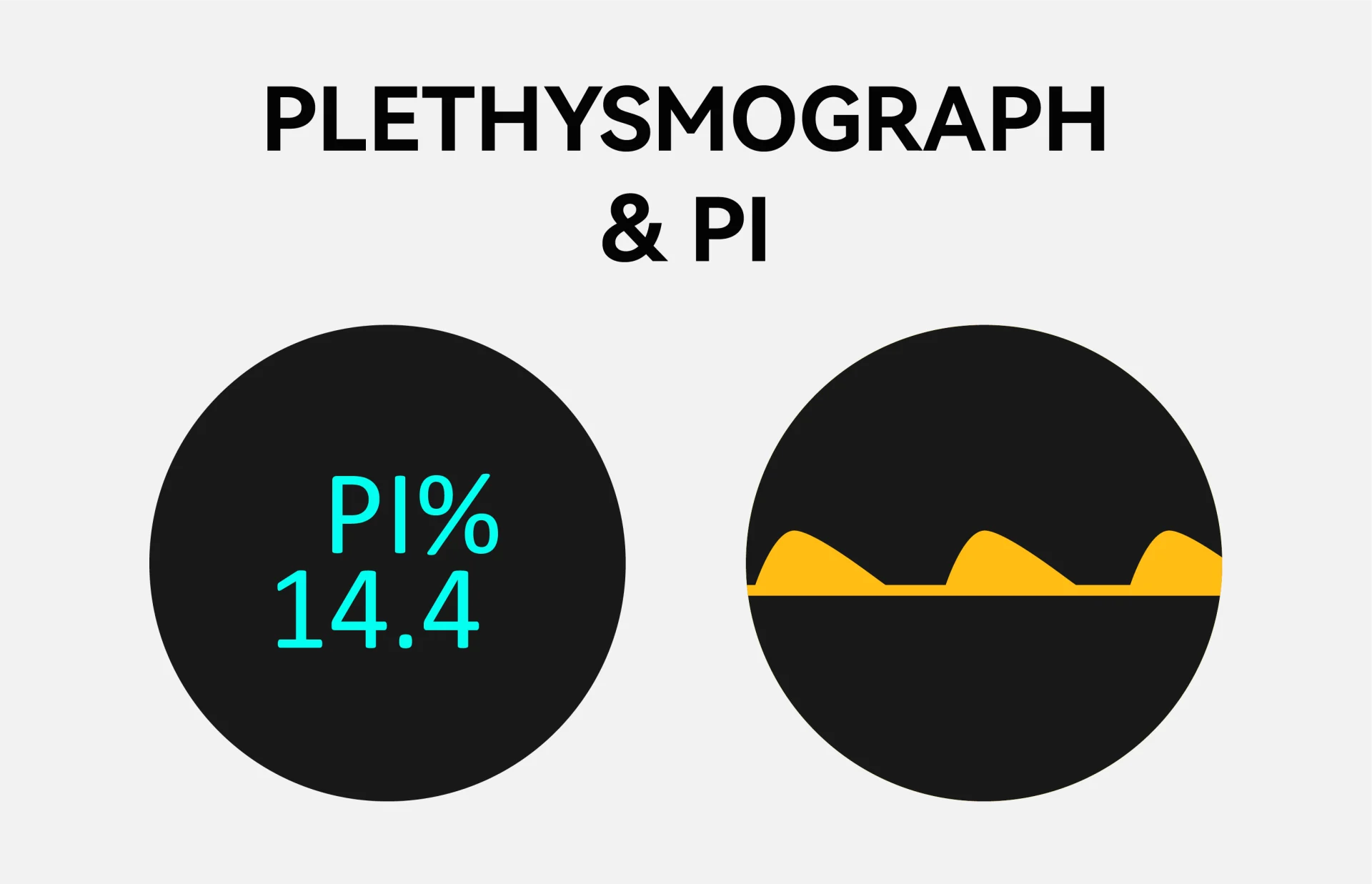 Plethysmograph & PI
